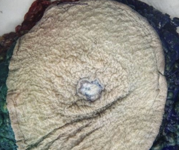 Description of the image